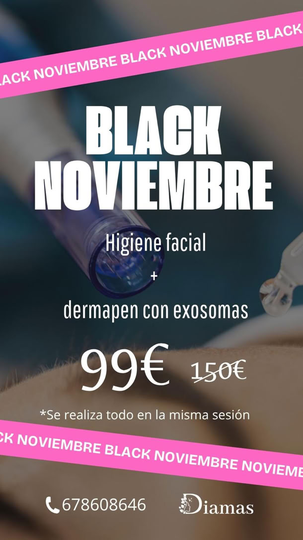 BLACK FRIDAY MALAGA. BLACK NOVIEMBRE MALAGA. HIGIENE FACIAL MALAGA CAPITAL. ESTETICA MALAGA CAPITAL. DERMAPEN CON EXOSOMAS MALAGA. HIGIENE FACIAL MAS DERMAPEN MALAGA