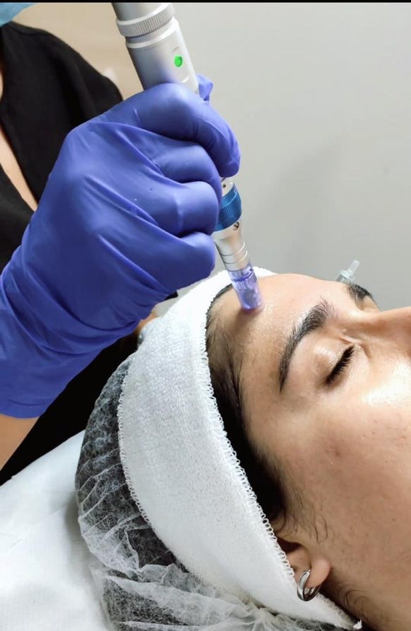 Tratamientos Faciales Diamas, tratamientos indoloros, belleza, Málaga centro, estética en Málaga centro